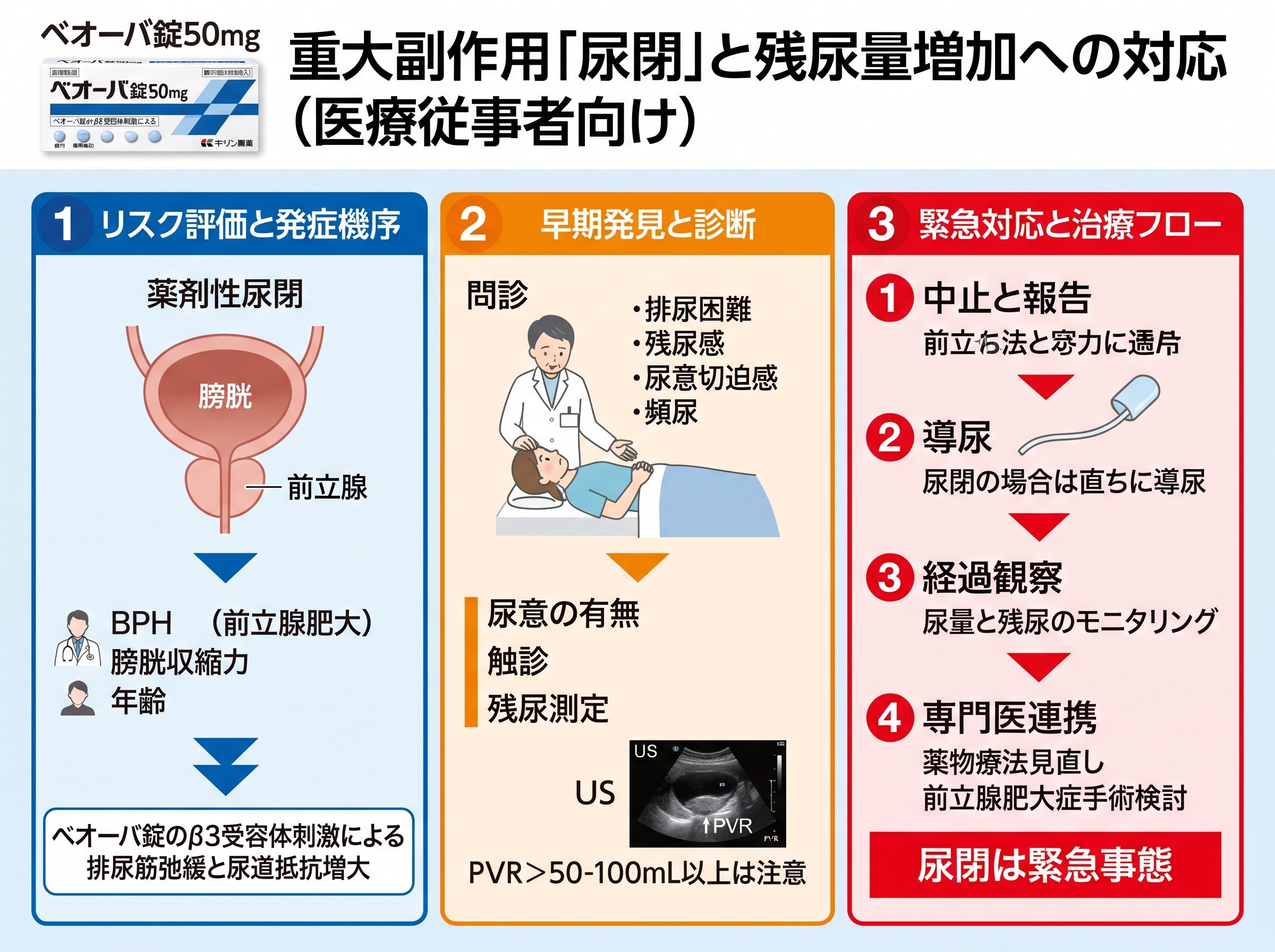 ベオーバ錠50mgの重大な副作用「尿閉」と残尿量増加への対応