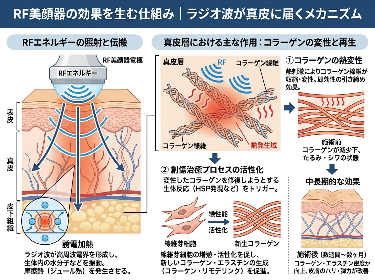 RF美顔器の効果を生む仕組み|ラジオ波が真皮に届くメカニズム