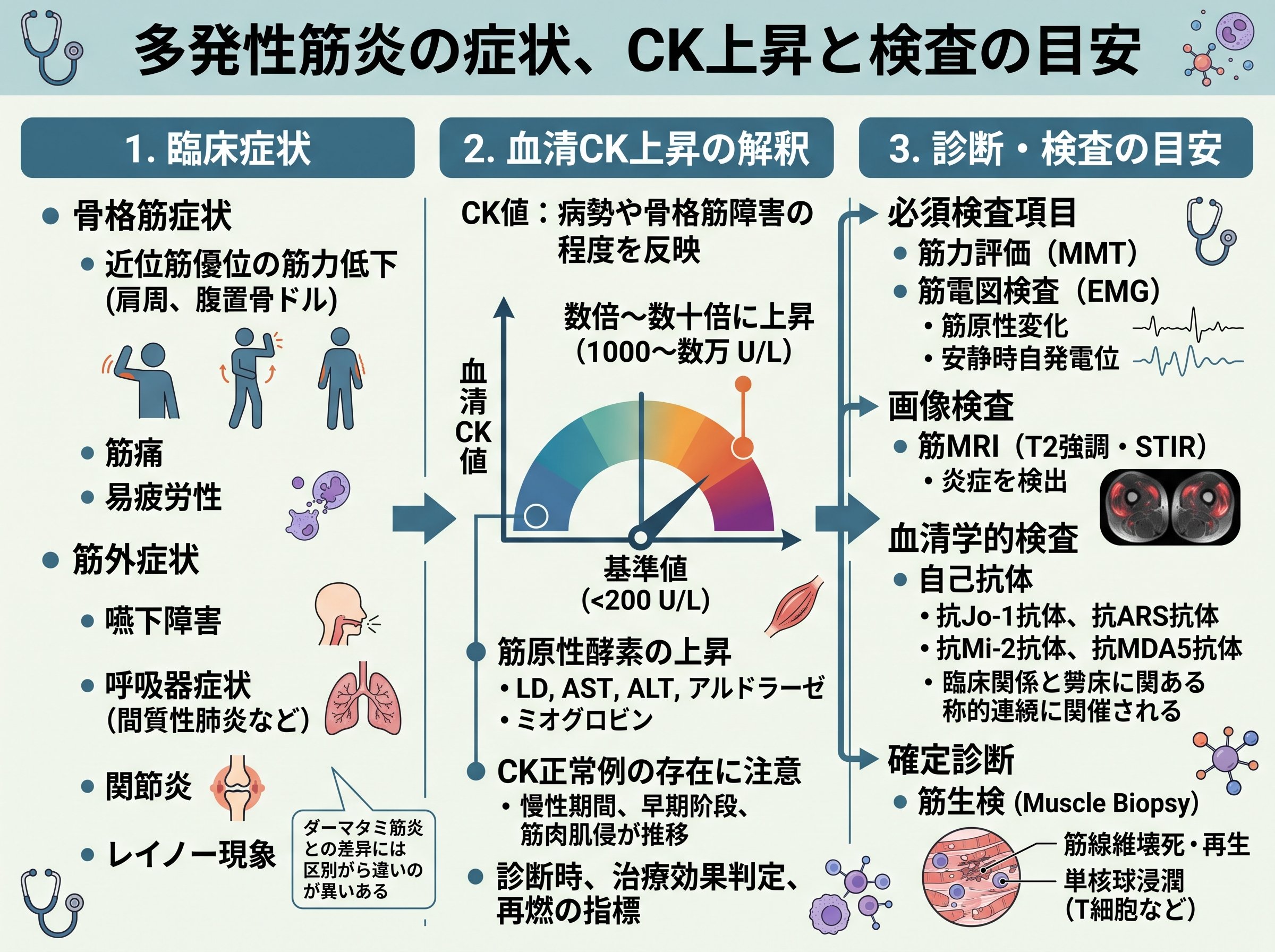 多発性筋炎 症状 CK上昇と検査の目安
